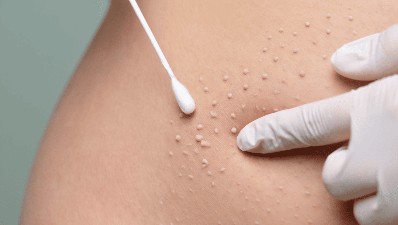 Tubercules de Montgomery sans grossesse: causes hormonales